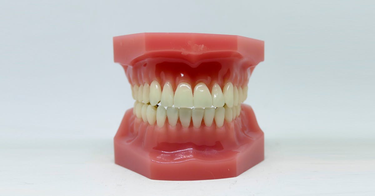 L’occlusion : comprendre son impact sur votre piercing