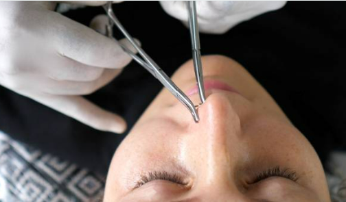Quels piercings corporels font le plus mal ?