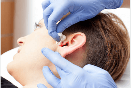 Comment traiter un piercing d’oreille infecté